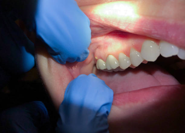 Best Emergency Dental Care for Sports Injuries in New Tazewell, TN