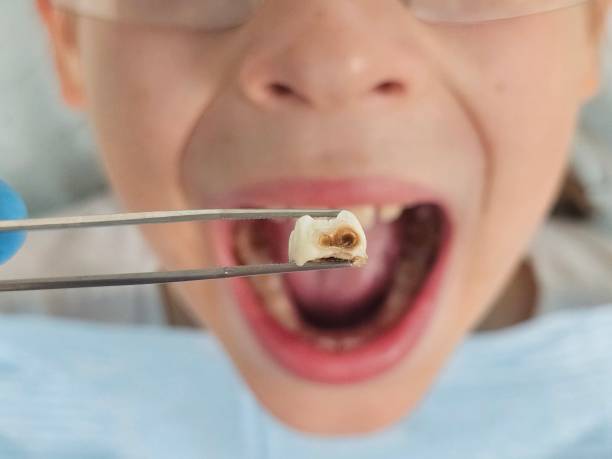 Best Walk-In Emergency Dental Services in New Tazewell, TN
